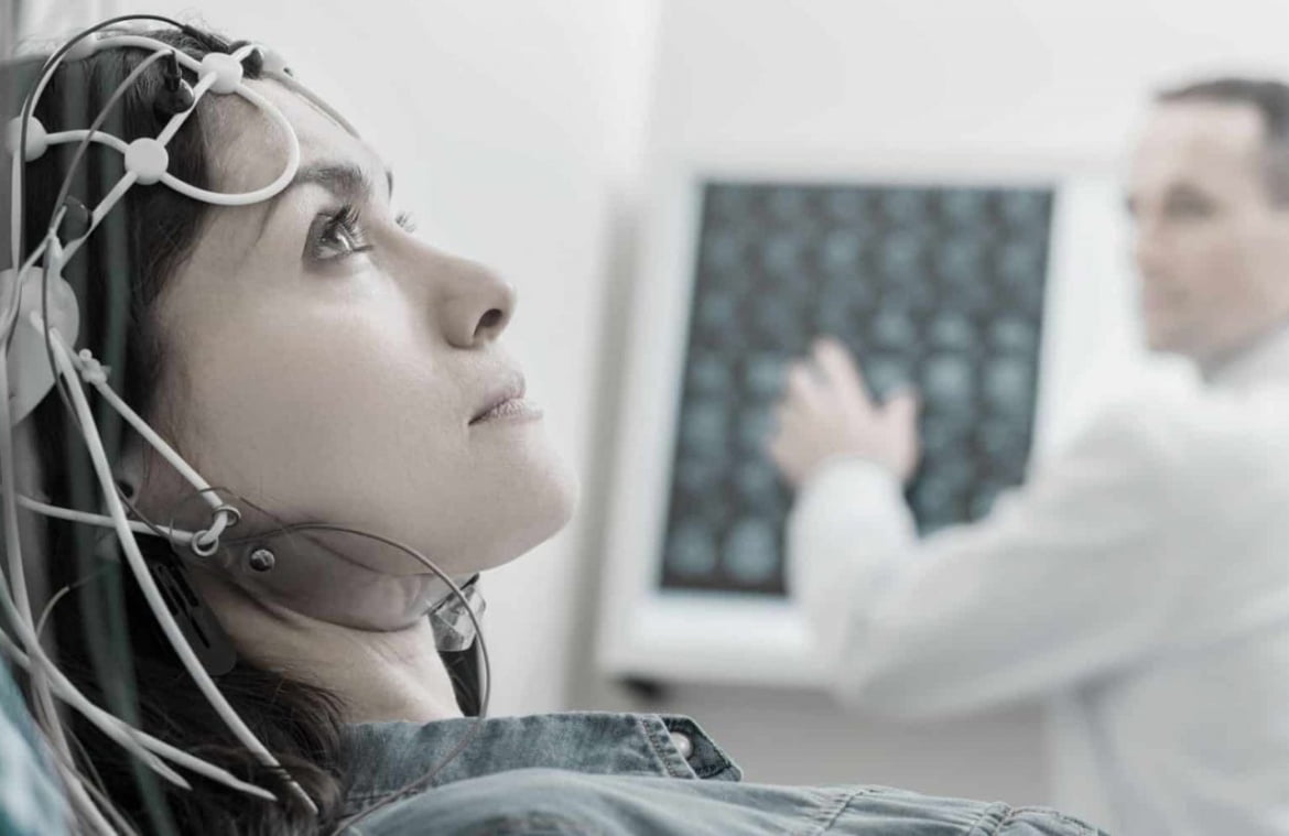 microstimulare electrica transcraniana TDCS